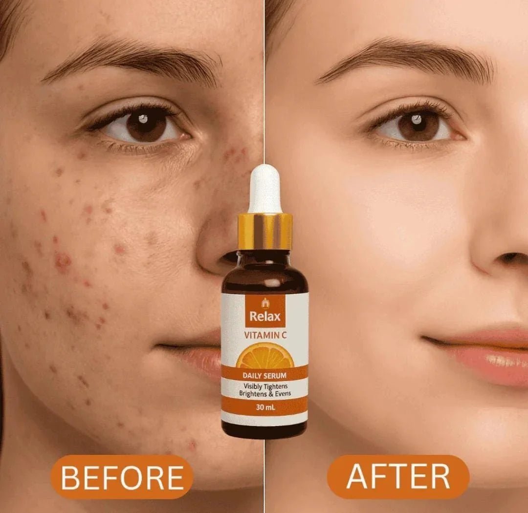 Relax Vitamin C Daily Serum 30ml – Brightening & Anti-Aging Facial Serum | Face Serum | Peach Slice Skin